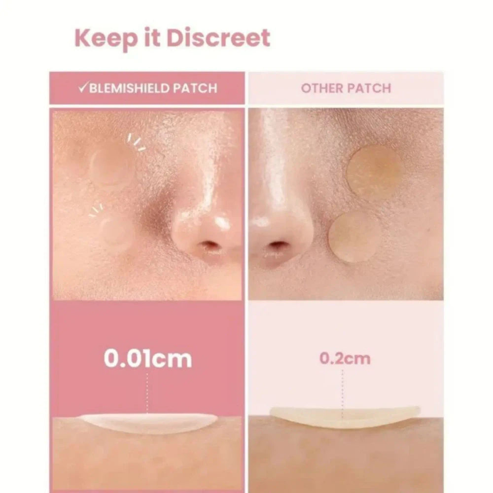 Star Acne Patches
